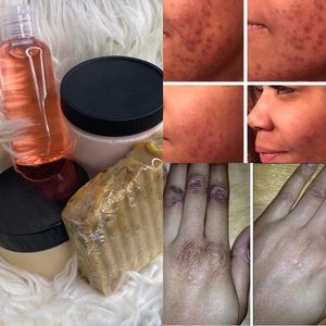 Crimel set ( light skin recommended always